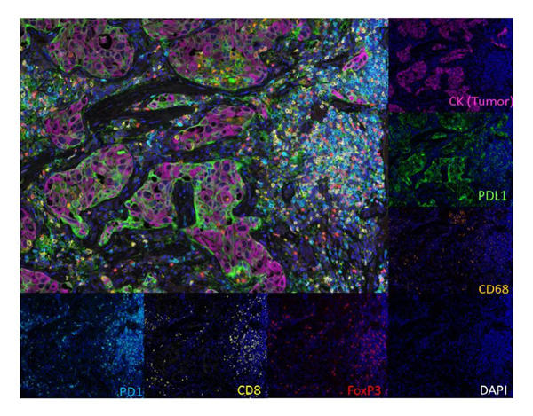 Figure 1. mIHC technique to detect multispectral images