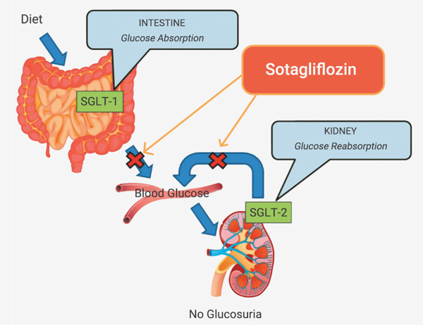 Fig 11. Dual SGLT1 and SGLT2 inhibitions with Sotagliflozin