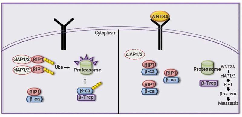 Fig 6. Model of RIP1's role in CRC metastasis