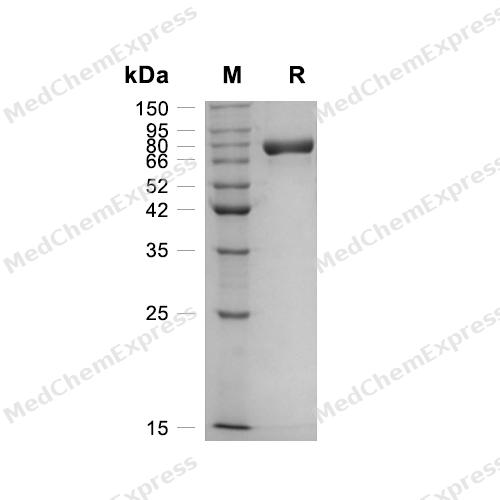 Experimental Validation Results for Semaphorin-4A/SEMA4A Protein, Mouse (HEK293, His)