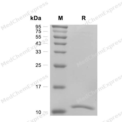 Experimental Validation Results for Zika virus E/Envelope Protein (HEK293, His)