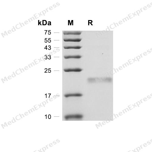 Experimental Validation Results for CSRP1 Protein, Human (His)