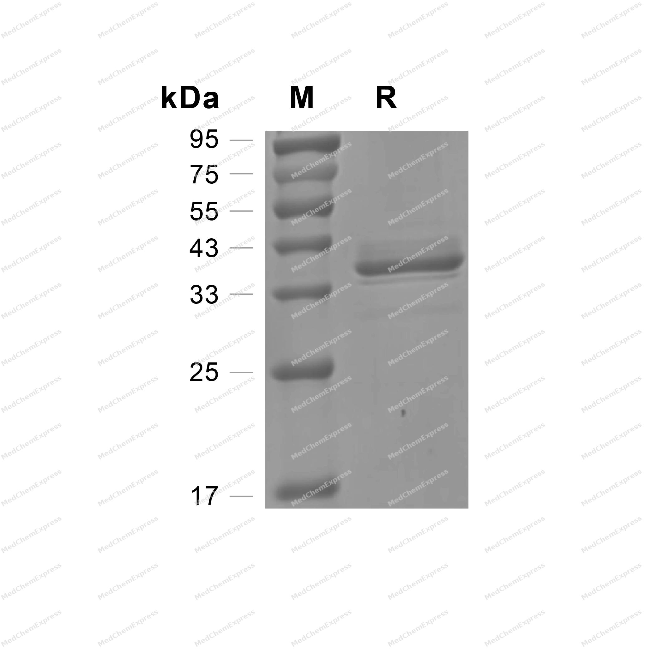 Experimental Validation Results for SPINK2 Protein, Human (HEK293, Fc)