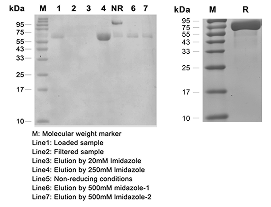 Mammalian Expression System