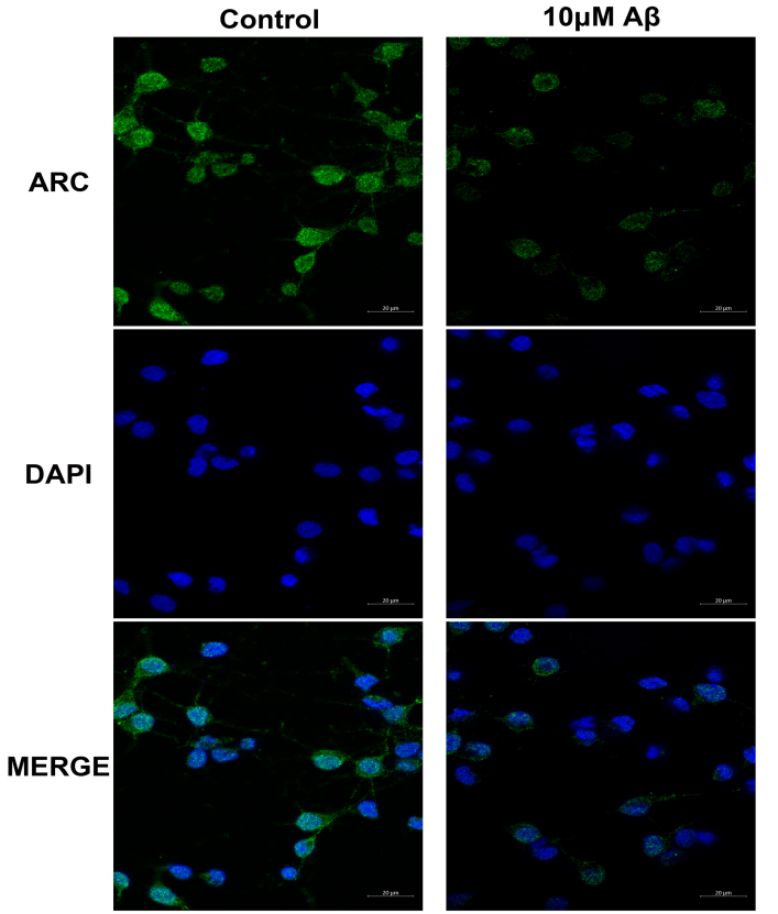 β-Amyloid (1-42), human TFA (Amyloid β-peptide (1-42) (human) TFA