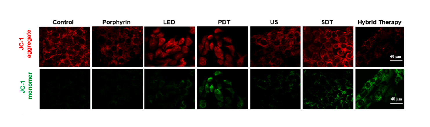 JC-1 Mitochondrial Membrane Potential Assay Kit | MedChemExpress