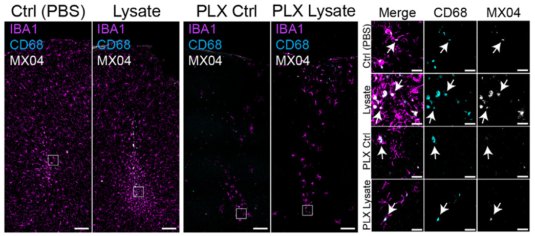 PLX5622 | CSF1R Inhibitor | MedChemExpress