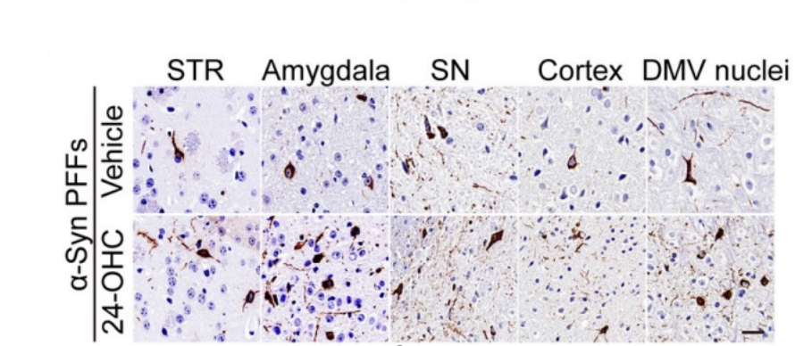 Experimental Validation Results for 24-Hydroxycholesterol