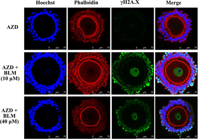 AZD-7762 | Chk Inhibitor | MedChemExpress