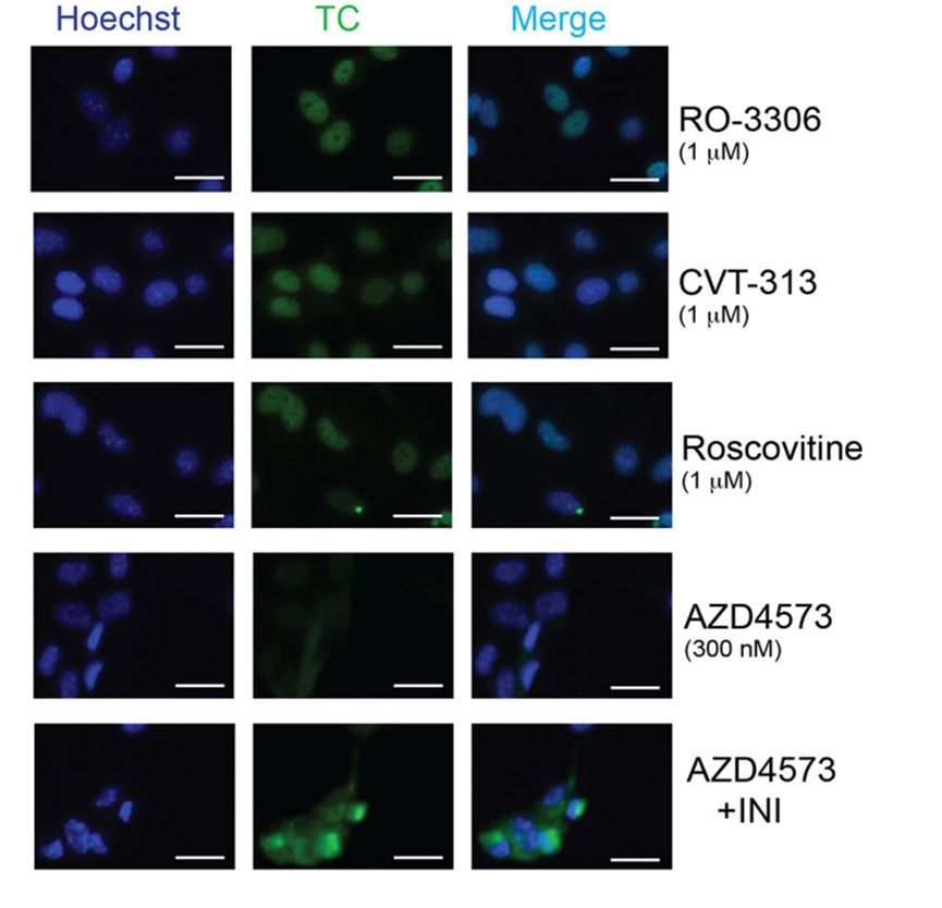 AZD4573 | CDK9 Inhibitor | MedChemExpress