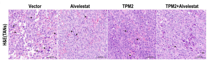 Experimental Validation Results for Alvelestat hydrochloride