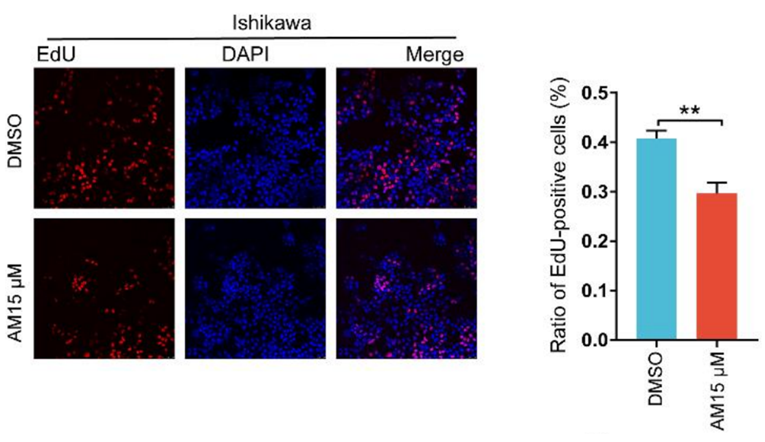 amlodipine and glutathione amlodipine l main image 1
