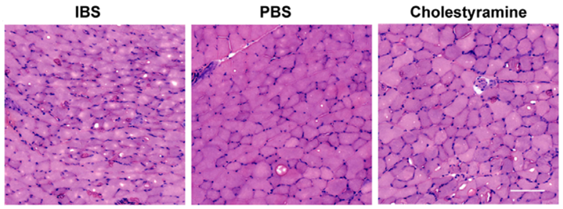Experimental Validation Results for Cholestyramine
