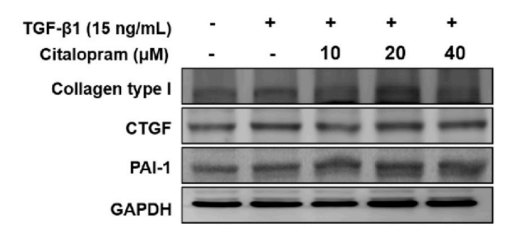 Experimental Validation Results for Citalopram hydrobromide