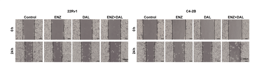 Experimental Validation Results for Dalpiciclib