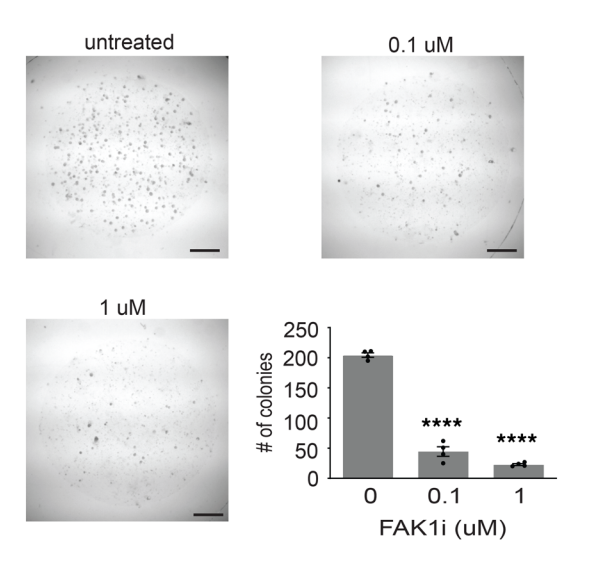 Experimental Validation Results for GSK2256098