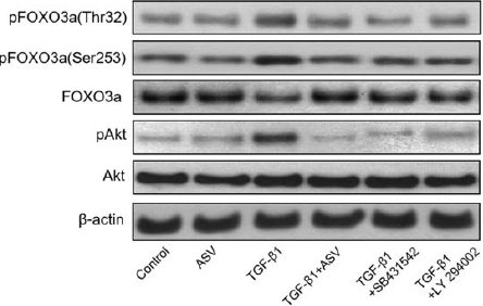 LY294002 | PI3K Inhibitor | MedChemExpress