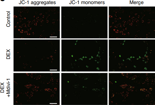 Mdivi-1 (Mitochondrial division inhibitor 1) | Drp1 Inhibitor