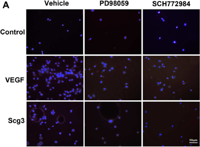 PD98059 | MEK Inhibitor | MedChemExpress
