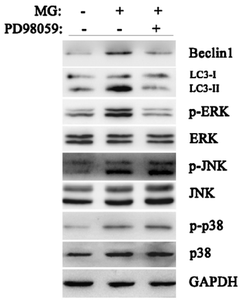 PD98059 | MEK Inhibitor | MedChemExpress