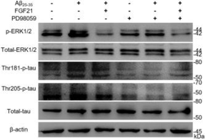 PD98059 | MEK Inhibitor | MedChemExpress