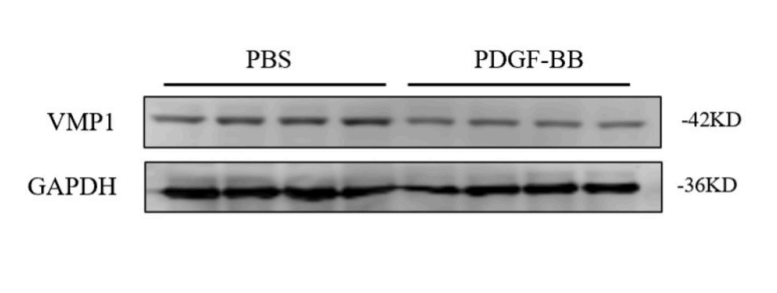 Experimental Validation Results for PDGF-BB Protein, Human (His)