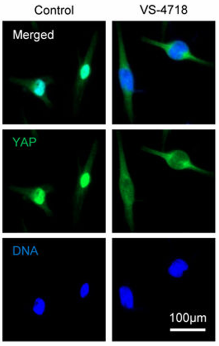 Experimental Validation Results for PND-1186 hydrochloride