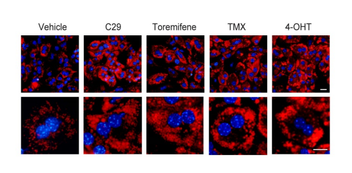 glutathione consent form pdf Evaluation of tamoxifen and simvastatin as the combination therapy for the  treatment of hormonal dependent breast cancer cells