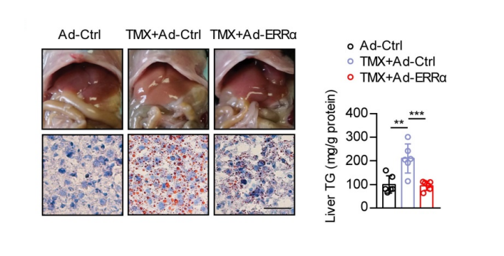 glutathione consent form pdf Ferroptosis, Acyl Starvation, and Breast Cancer main image 1