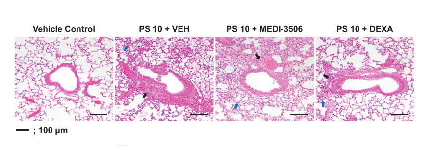 Experimental Validation Results for Tozorakimab