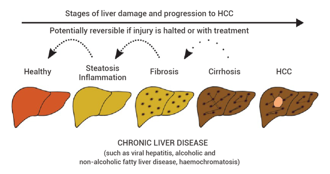 Animal Modeling: Methods for Establishing Common Liver Disease Models