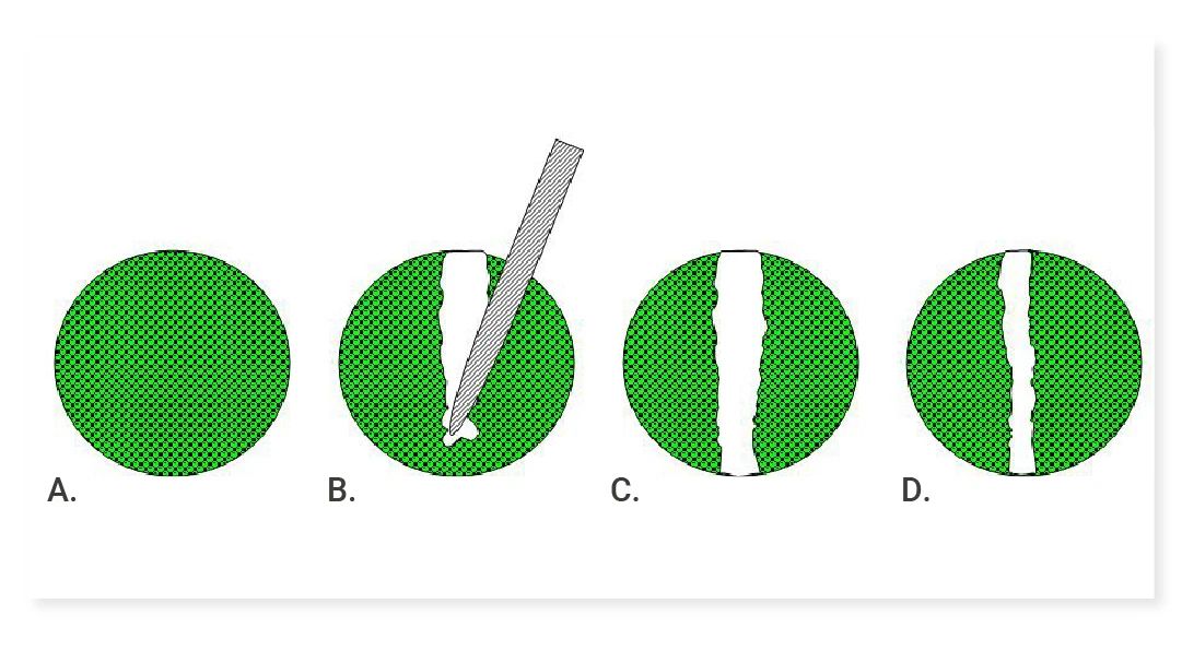 Cell Migration vs. Invasion: Differences Revealed by Scratch Assays and Transwell Experiments
