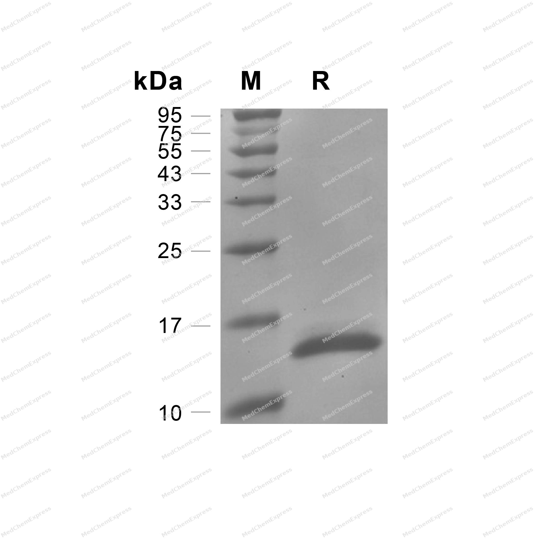 GM-CSF Protein, Human | MedChemExpress