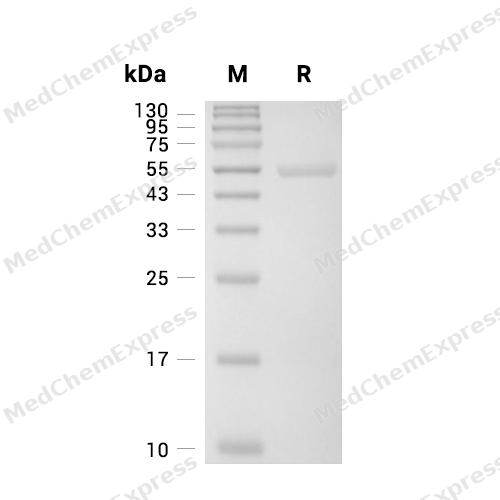 Glutathione synthetase/GSS Protein, Human (His)