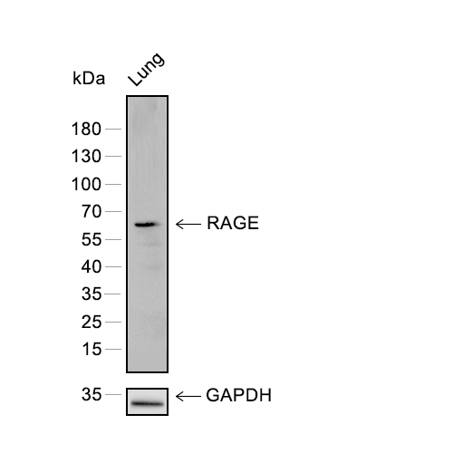 RAGE Antibody | MedChemExpress